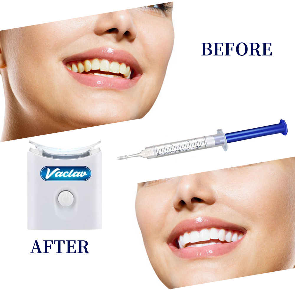 Mint Teeth Whitening Gel Syrin - Teeth Whitening Kit At Home 评论和价格