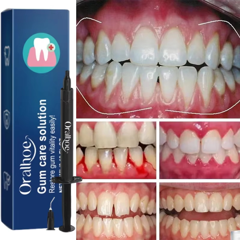 Teeth Whitening Gel Gum Repair - Teeth Whitening Gel 评论和价格