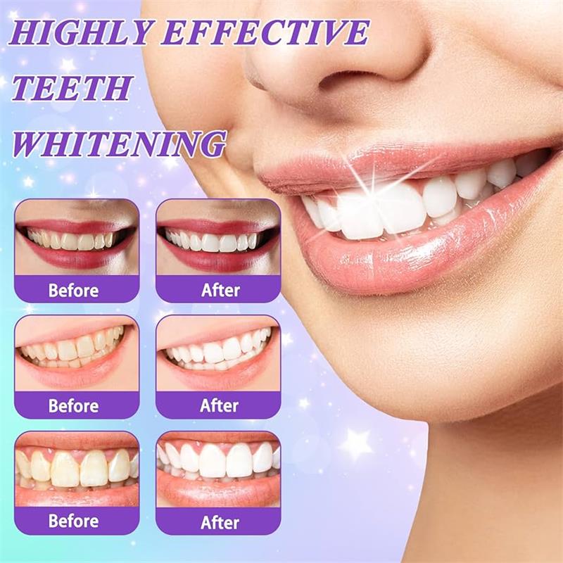 9D Purple Teeth Whitening Toot - Teeth Whitening Treatment 评论和价格