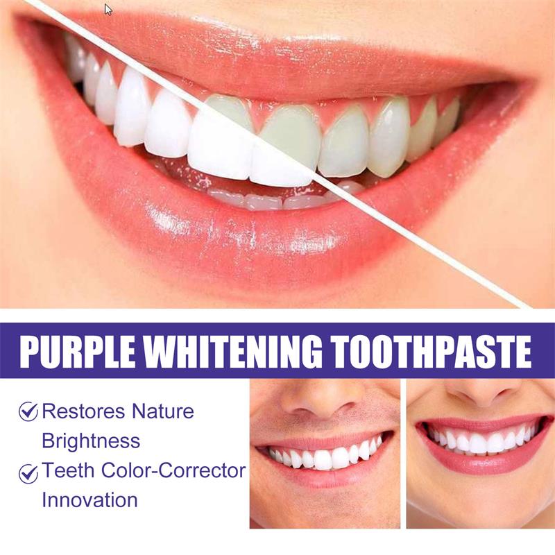 9D Purple Teeth Whitening Toot - Teeth Whitening Treatment 评论和价格