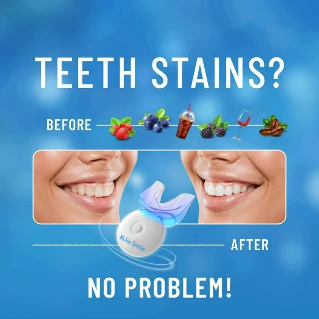 High Quality Cleaning Kit Wire - Teeth Whitening Kit At Home 评论和价格