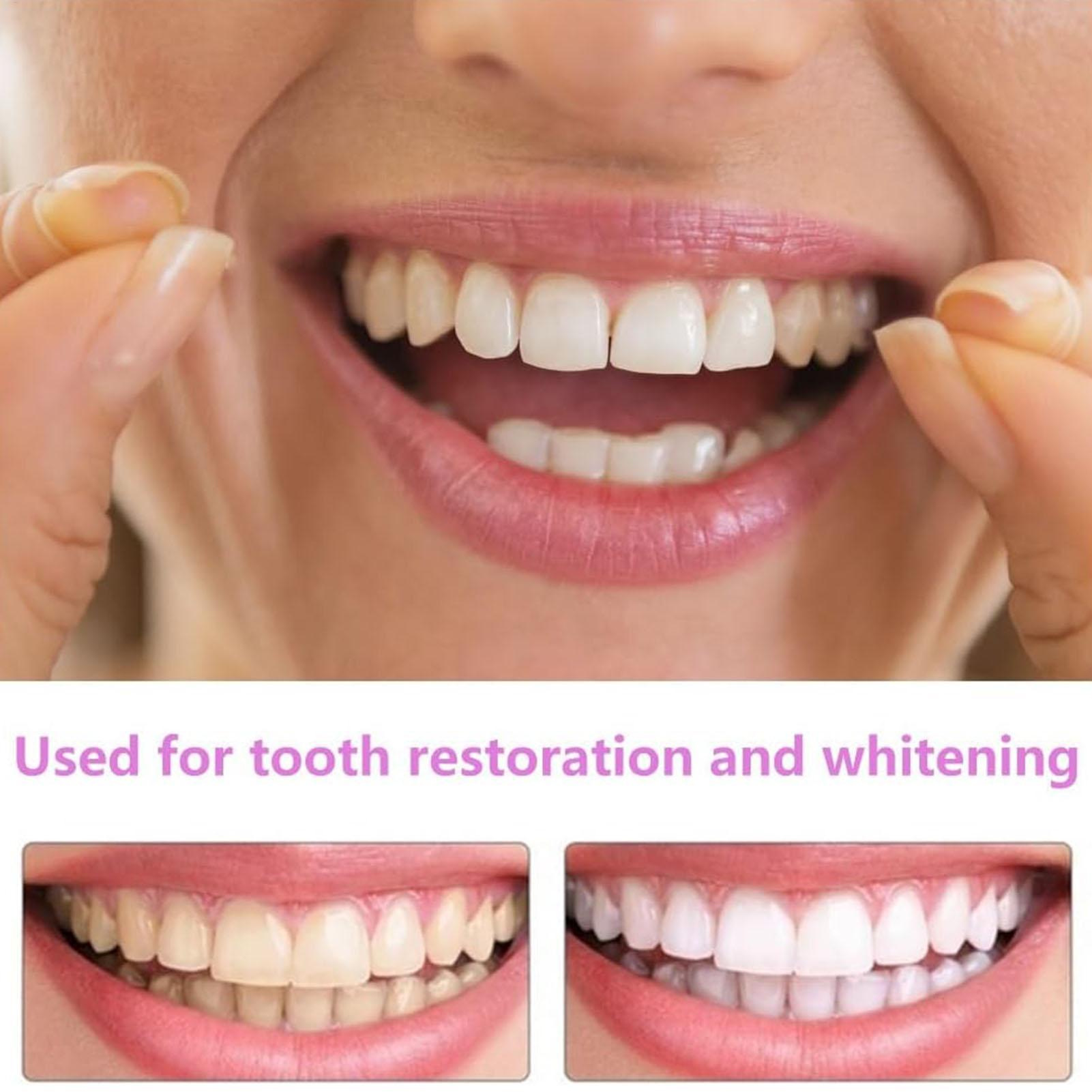 Tooth Veneers Upper Lower Vene - Teeth Whitening Mask 评论和价格