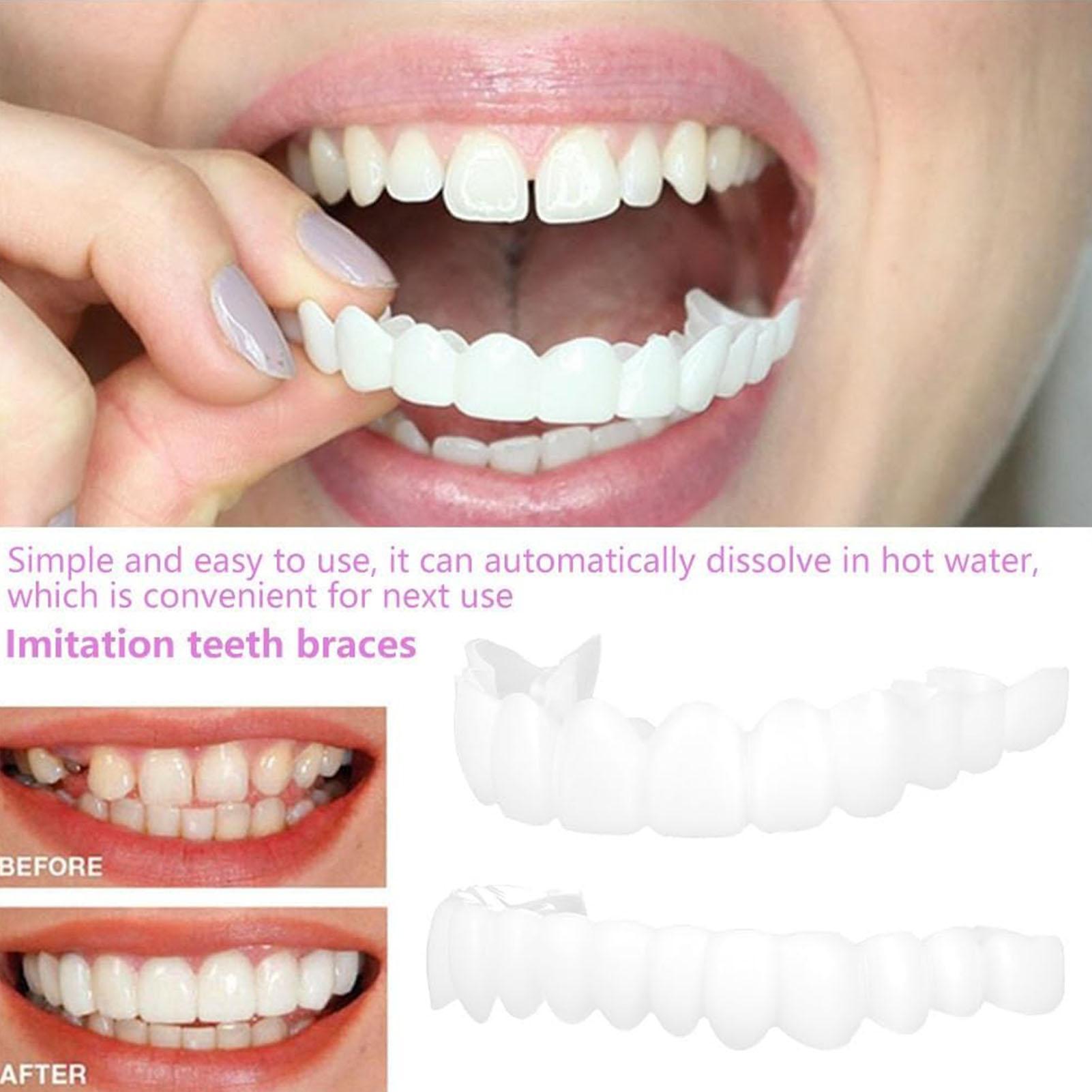 Tooth Veneers Upper Lower Vene - Teeth Whitening Mask 评论和价格