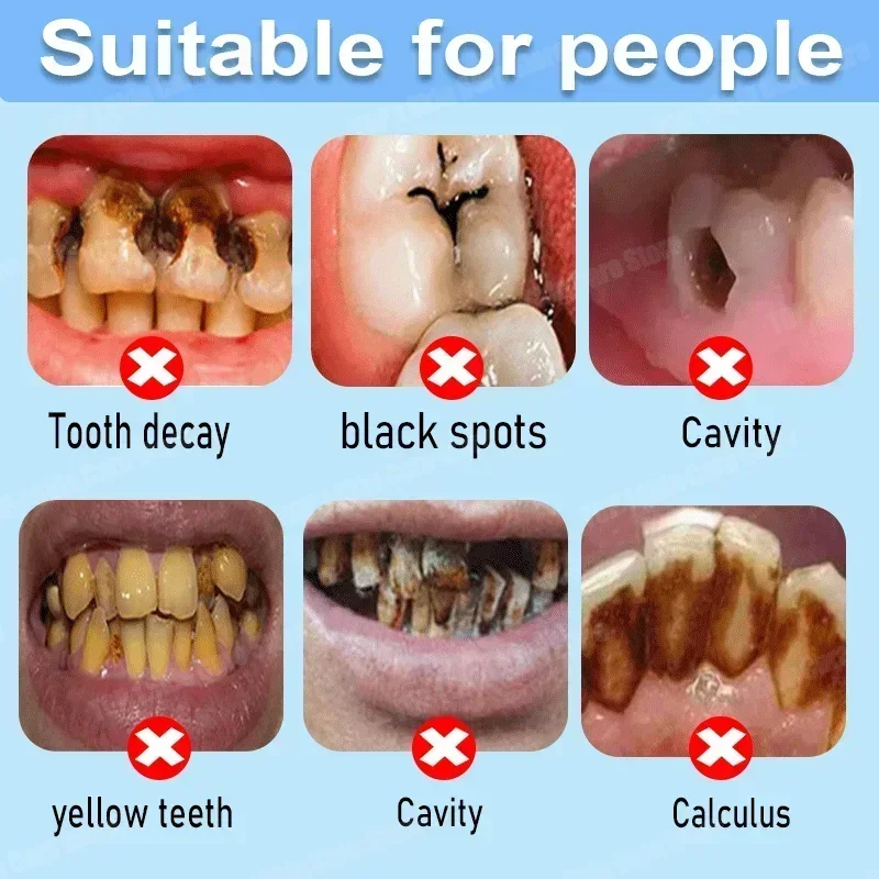 Anti Decay Toothpaste Repairs  - Teeth Whitening Treatment 评论和价格