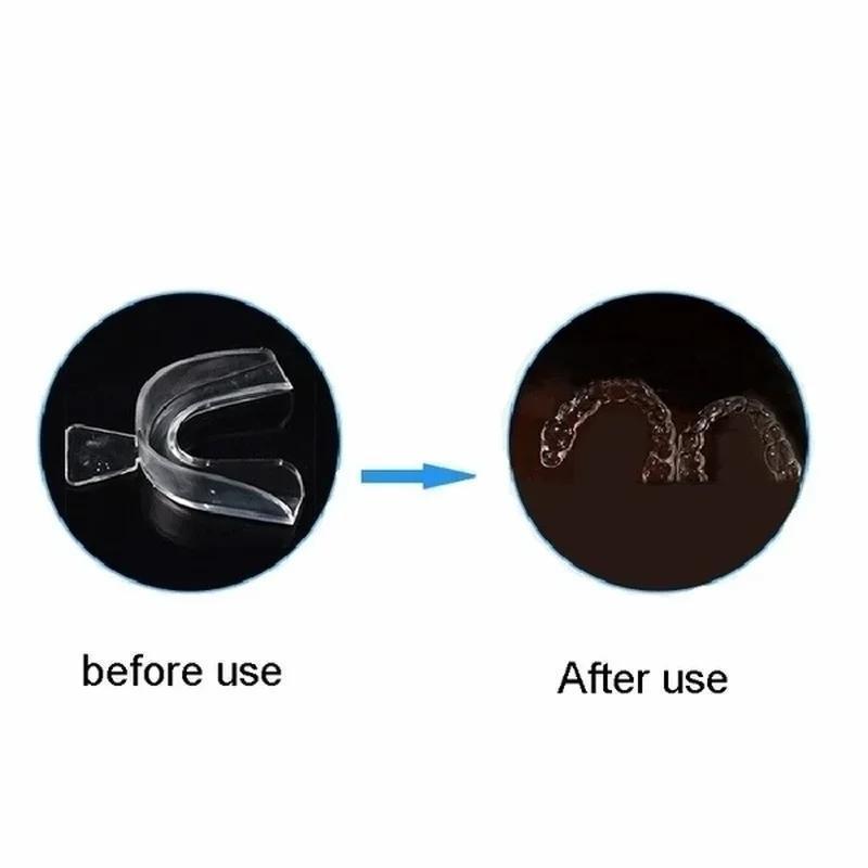 Professional Teeth Whitening T - Teeth Whitening Kit At Home 评论和价格