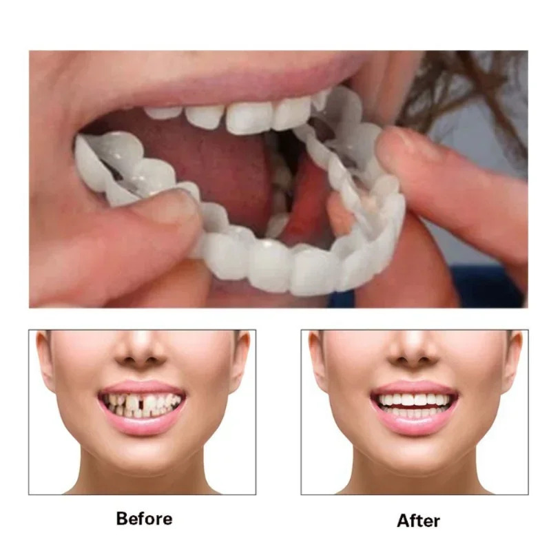 Perfect Fit Teeth Whitening Fa - Teeth Whitening Mask 评论和价格