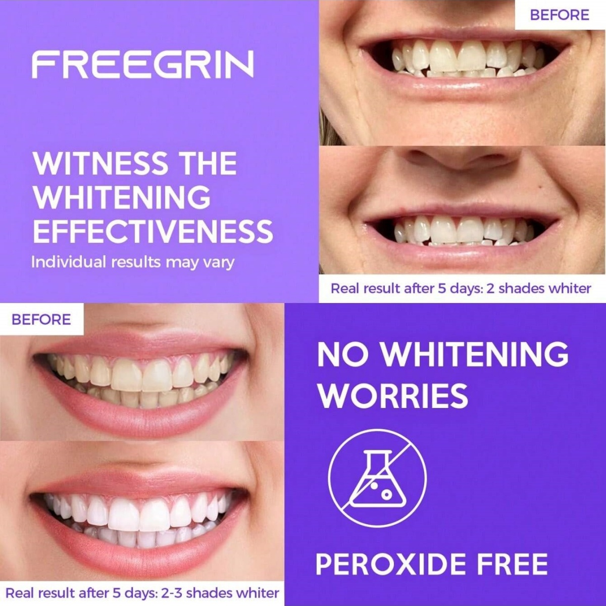 Deluxe Whitening Teeth Sticker - Teeth Whitening App 评论和价格