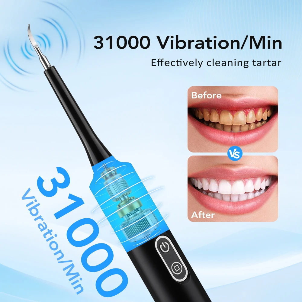 Electric Sonic Vibration Denta - Teeth Whitening Toothbrush 评论和价格